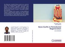 Copertina di Bone Grafts in Periodontal Regeneration