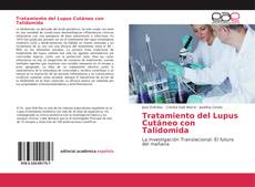 Bookcover of Tratamiento del Lupus Cutáneo con Talidomida