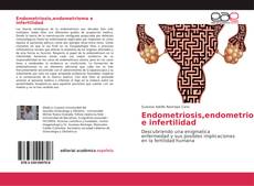 Buchcover von Endometriosis,endometrioma e infertilidad