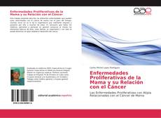 Copertina di Enfermedades Proliferativas de la Mama y su Relación con el Cáncer