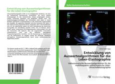 Buchcover von Entwicklung von Auswertealgorithmen für die Leber-Elastographie