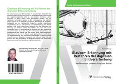 Portada del libro de Glaukom Erkennung mit Verfahren der digitalen Bildverarbeitung