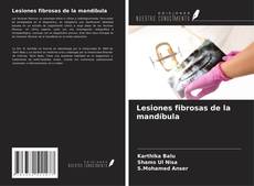Buchcover von Lesiones fibrosas de la mandíbula