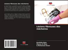 Portada del libro de Lésions fibreuses des mâchoires