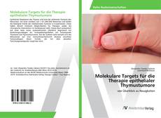 Bookcover of Molekulare Targets für die Therapie epithelialer Thymustumore