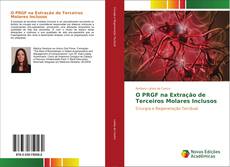 Bookcover of O PRGF na Extração de Terceiros Molares Inclusos