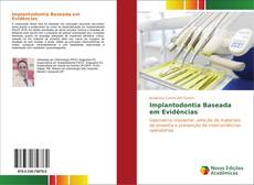 Bookcover of Implantodontia Baseada em Evidências