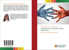 Bookcover of Sistemas de retenção sobre implantes