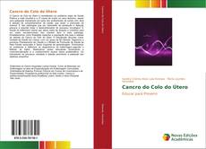 Bookcover of Cancro do Colo do Útero
