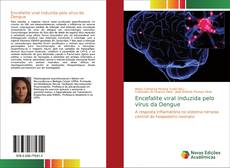 Capa do livro de Encefalite viral induzida pelo vírus da Dengue 