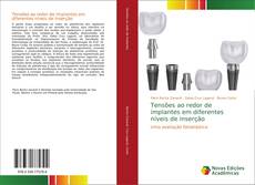 Portada del libro de Tensões ao redor de implantes em diferentes níveis de inserção