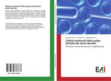 Bookcover of Cellule staminali della polpa dentale dei denti decidui