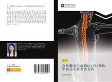 Bookcover of 急性髓系白血病GLIPR1基因甲基化及其表达分析