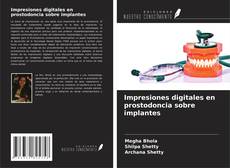 Buchcover von Impresiones digitales en prostodoncia sobre implantes