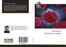 Buchcover von Parotid tumors in Egypt