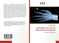 Bookcover of Évaluation à 6 mois de 205 patients Sénégalais