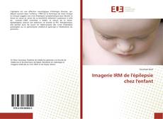 Capa do livro de Imagerie IRM de l'épilepsie chez l'enfant 