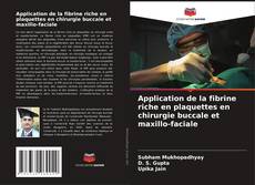 Copertina di Application de la fibrine riche en plaquettes en chirurgie buccale et maxillo-faciale