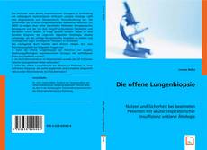 Die offene Lungenbiopsie的封面