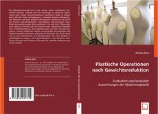 Copertina di Plastische Operationen nach Gewichtsreduktion