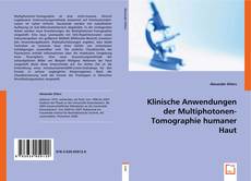 Klinische Anwendungen der Multiphotonen-Tomographie humaner Haut kitap kapağı