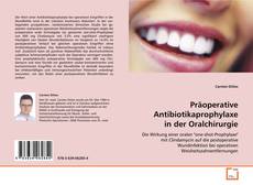 Präoperative Antibiotikaprophylaxe in der
Oralchirurgie kitap kapağı