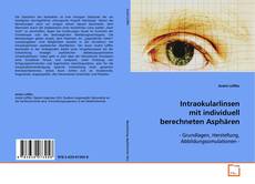 Buchcover von Intraokularlinsen mit individuell berechneten
Asphären