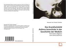 Bookcover of Das Krankheitsbild Asthma bronchiale in der
Geschichte der Medizin