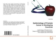 Capa do livro de Epidemiology of Prostate Cancer in Developing
Countries 