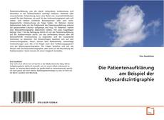 Copertina di Die Patientenaufklärung am Beispiel der
Myocardszintigraphie
