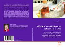 Copertina di Effects of Src-inhibitors on osteoclasts in vitro