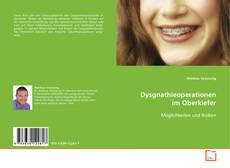Capa do livro de Dysgnathieoperationen im Oberkiefer 