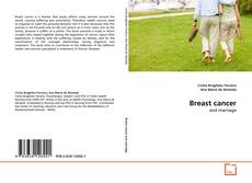 Copertina di Breast cancer