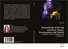 Capa do livro de Osteoarthritis of the Hip and Knee: Causes,
Consequences and Control 