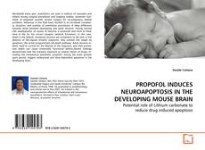 Borítókép a  PROPOFOL INDUCES NEUROAPOPTOSIS IN THE DEVELOPING
MOUSE BRAIN - hoz
