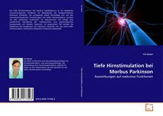 Borítókép a  Tiefe Hirnstimulation bei Morbus Parkinson - hoz