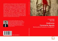 Buchcover von Síndrome Coronario Agudo