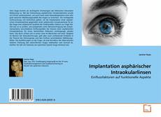 Portada del libro de Implantation asphärischer Intraokularlinsen