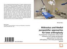 Couverture de Midvastus and Medial parapatellar approaches for knee arthroplasty