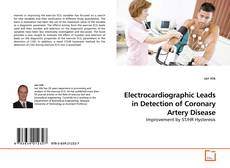 Couverture de Electrocardiographic Leads in Detection of Coronary Artery Disease
