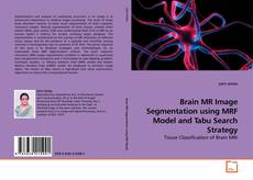 Buchcover von Brain MR Image Segmentation using MRF Model and Tabu Search Strategy