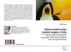 Buchcover von Manual small incision cataract surgery in India