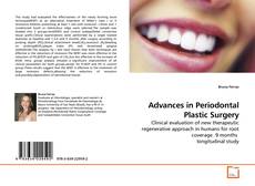 Couverture de Advances in Periodontal Plastic Surgery