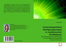 Buchcover von Computergestützte Bewegungsanalyse in medizinischen 4D-Bilddaten