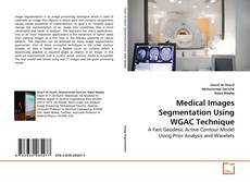 Buchcover von Medical Images Segmentation Using WGAC Technique
