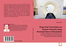 Copertina di Drop Foot Correction on Uneven Ground using Peroneal Nerve Stimulation