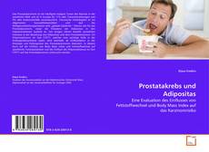 Borítókép a  Prostatakrebs und Adipositas - hoz