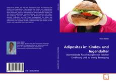 Adipositas im Kindes- und Jugendalter的封面