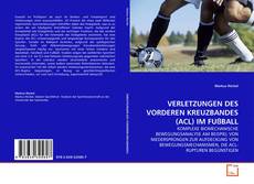 Copertina di VERLETZUNGEN DES VORDEREN KREUZBANDES (ACL) IM FUßBALL