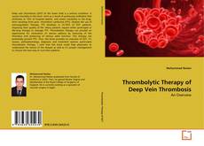 Buchcover von Thrombolytic Therapy of Deep Vein Thrombosis